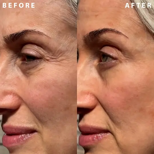 before and after of mature woman applying primer
