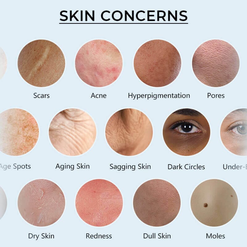 Chart showing common skin concerns like dryness, fine lines, and hyperpigmentation in mature skin.