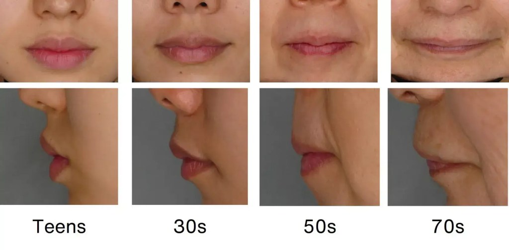 A series of facial close-ups from the front and side show the lips and lower face of a person at different ages: teens, 30s, 50s, and 70s, highlighting changes in lip shape and skin texture over time.